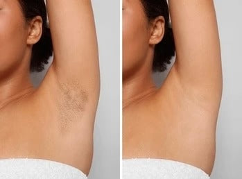 Velora™ After Shave & Wax Oil (Pack of 2)