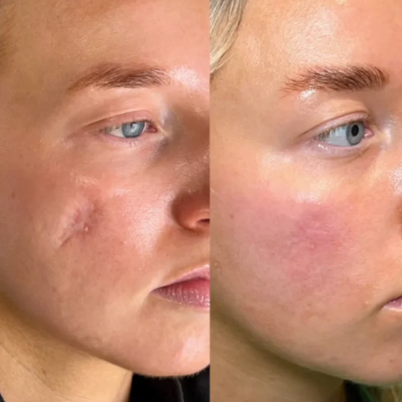 Velora™ Silicon Wrinkle-Reducing Stick